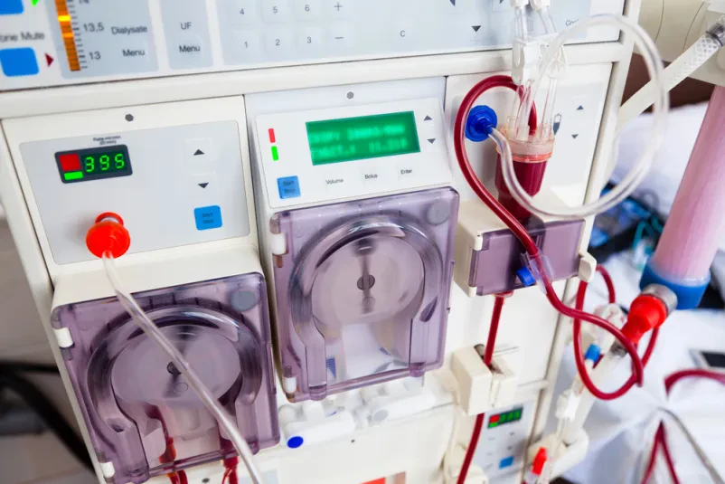 Servizi nefrologici e di medicina interna