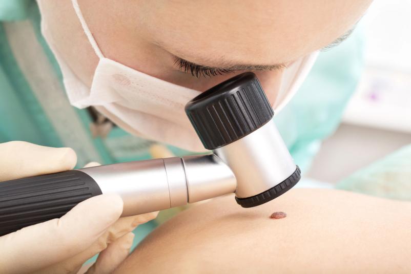 Dermatološki pregledi v Domžalah