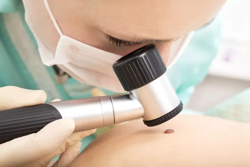 Dermatološki pregledi v Domžalah