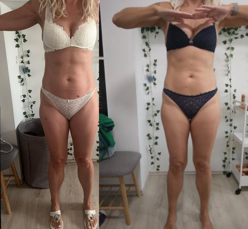 Infra estetica preolikovanje telesa Slovenska Bistrica