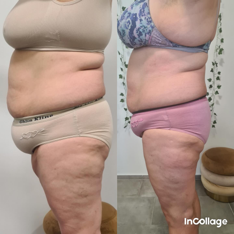 Infra vadba za hujšanje Slovenska Bistrica