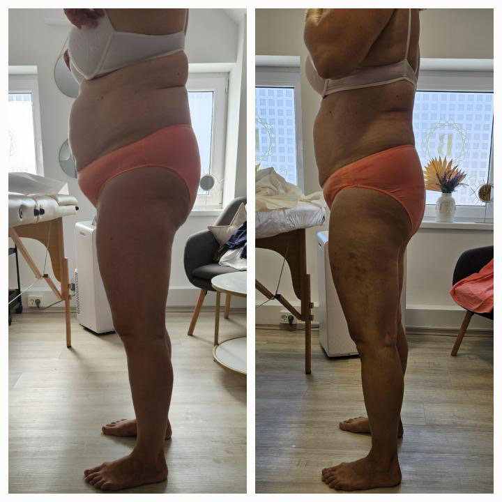 Infra vadba in tretmaji Slovenska Bistrica