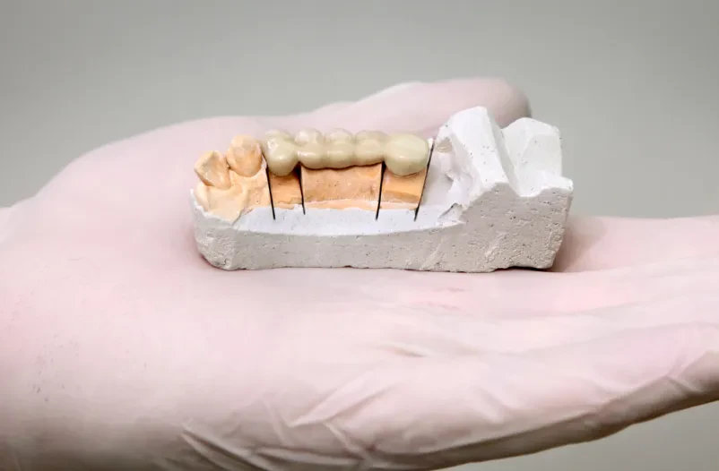 Dentalni studio za protetiko Osrednja Slovenija