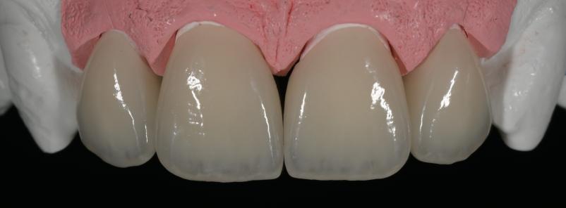 Dobri zobni venirji Ljubljana