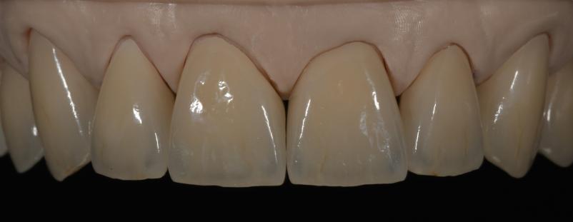 Lepi zobni venirji Ljubljana