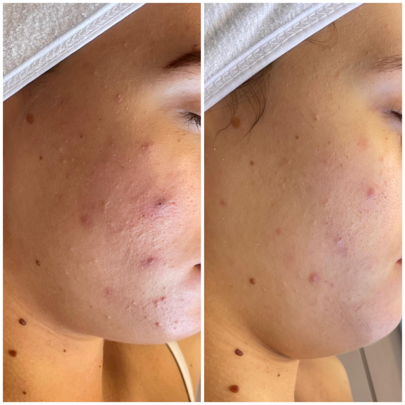 Lepotni obrazni tretmaji v Novi Gorici