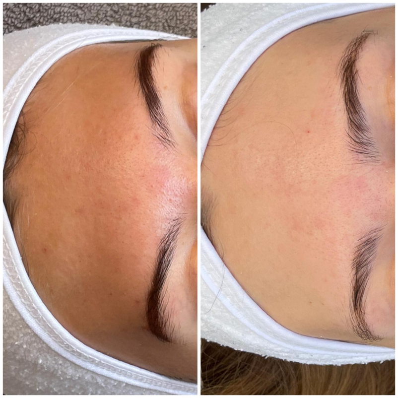 Strokovna nega obraza v Novi Gorici