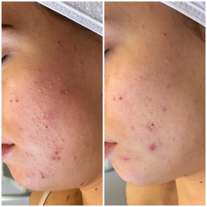 Kozmetični tretmaji za nego obraza v Novi Gorici