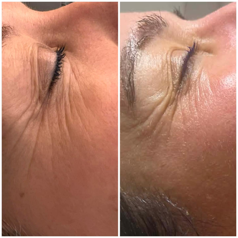 Tretmaji za nego kože na obrazu Nova Gorica