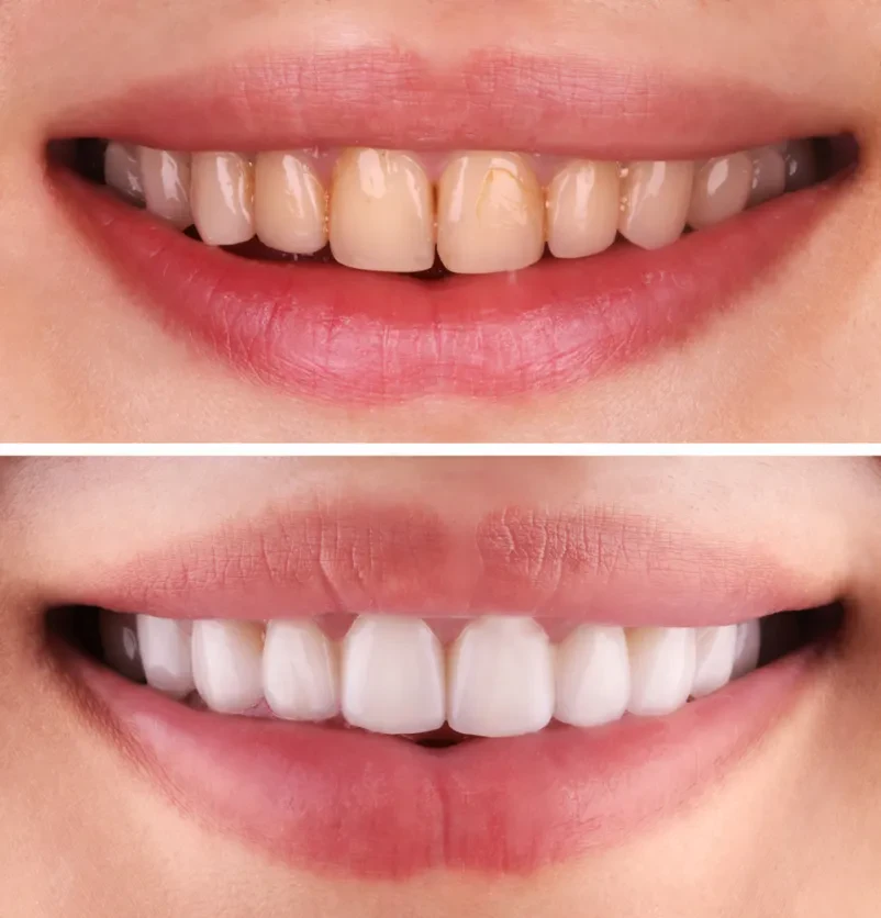 Preventivno zobozdravstvo in dentalna higiena Tolmin, Goriška