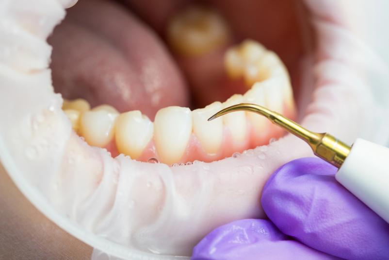 Zaseben zobozdravnik v Kranju