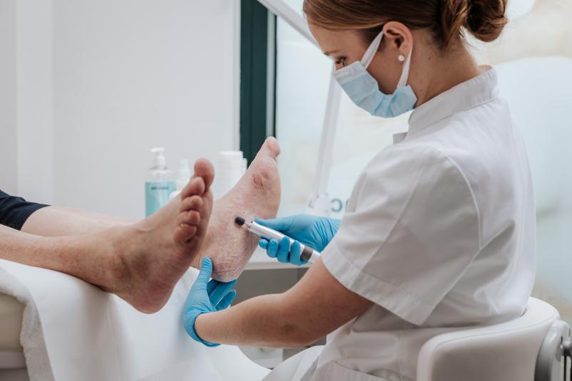 Sanacija vraščenega nohta po metodi AN NIKA