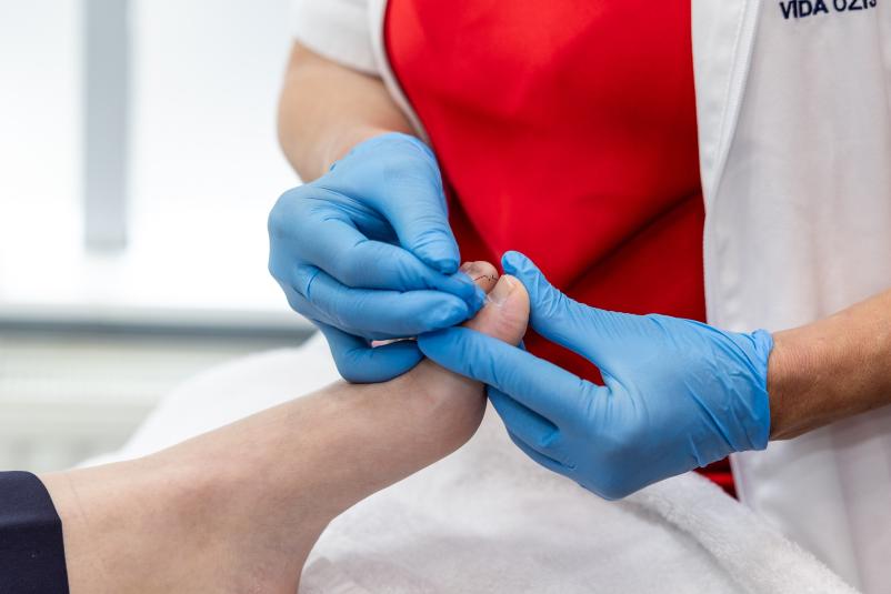 Kvalitetna medicinska pedikura AN.NIKA