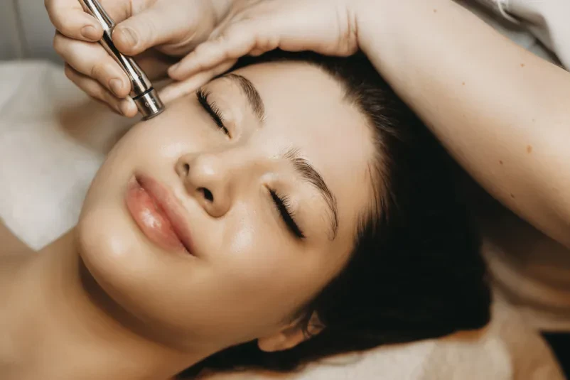 Dober microneedling Ljubljana