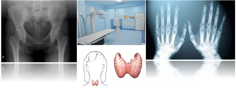 Ambulanta za bolezni ščitnice koncesija Maribor