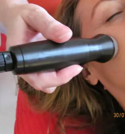 Celostna dermatoloska obdelava pacienta prekmurje