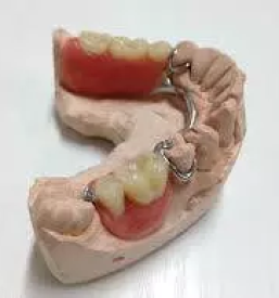 Dentalna protetika postojna