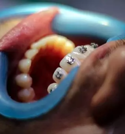 Dober samoplacniski zobozdravnik primorska