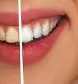 zobozdravnik samoplačnik Gorenjska