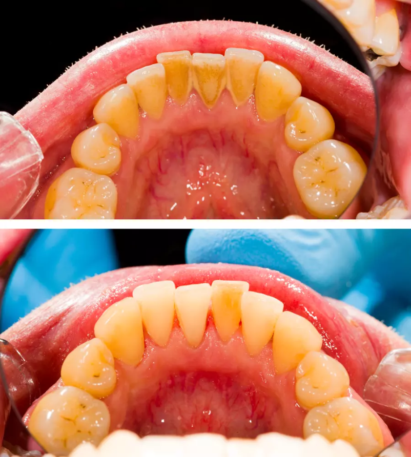Dobro estetsko zobozdravstvo Medvode, Trebnje
