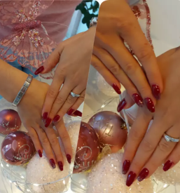 Gel nohti medicinska pedikura laser ipl nova gorica