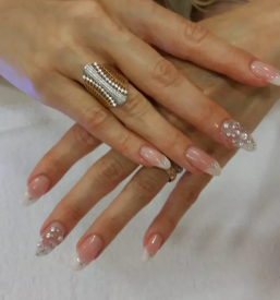 Gel nohti medicinska pedikura laser ipl nova gorica