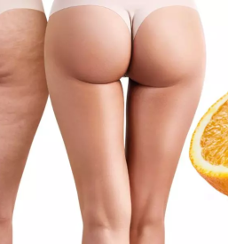 Hujsanje oblikovanje in ucvrstitev telesa nova gorica