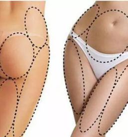 Hujsanje oblikovanje in ucvrstitev telesa nova gorica