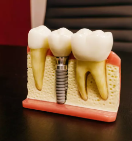 Kvaliteten zasebni zobozdravnik celje