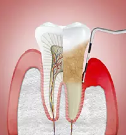 Kvalitetni zobni implantati ljubljana