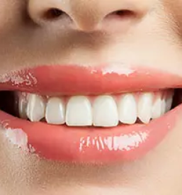 Kvalitetni zobni implantati ljubljana