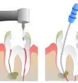 Kvalitetno zobozdravstvo ilirska bistrica