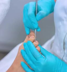 Medicinska pedikura dolenjska posavje goriska