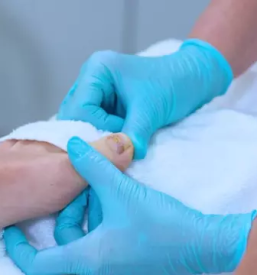 Medicinska pedikura dolenjska posavje goriska