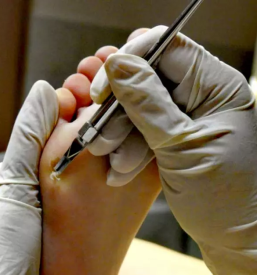 Salon za medicinsko pedikuro Maribor