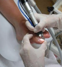 Najugodnejša medicinska pedikura Maribor