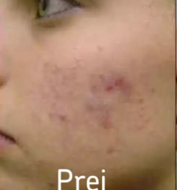 Nega obraza radovljica