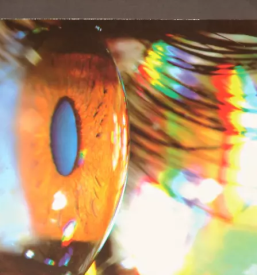 Očesna ordinacija ljubljana, dravlje, šiška