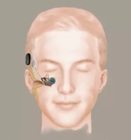 Nakup opreme za slušne aparate 