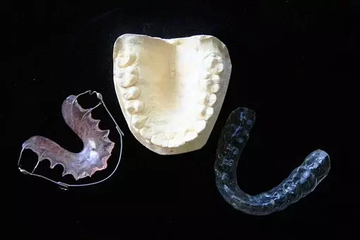 Prozorne zobne opornice Invisalign Dolenjska