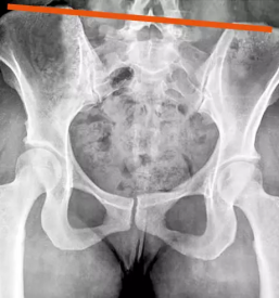 Psihoterapija osrednja slovenija