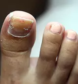 Resevanje glivicnih obolenj slovenija