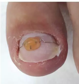 Resevanje glivicnih obolenj slovenija