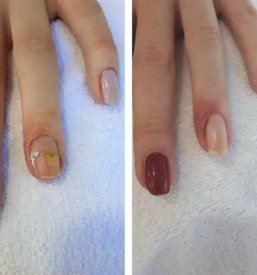 Resevanje glivicnih obolenj slovenija