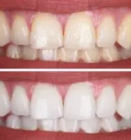 Samoplačniška zobna ambulanta Brežice, Slovenija