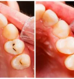 Samoplačniška zobna ambulanta Posavje