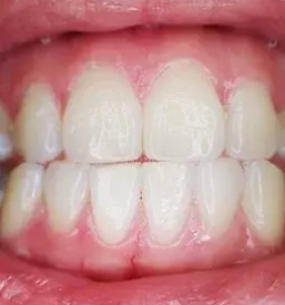 Samoplacniska zobna ordinacija maribor