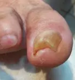 Sodoben center medicinske pedikure slovenija