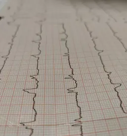 Specialisticna kardioloska ambulanta ljubljana