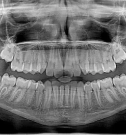 Ugoden zobni rentgen ljubljana